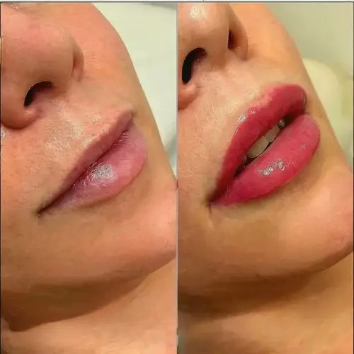 Permanent Eyeliner