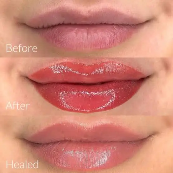 Lip blush