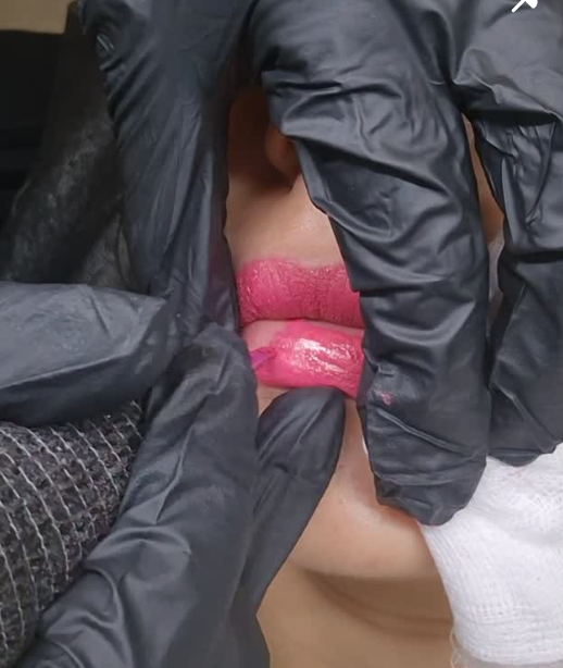 Lip blush treatment in progress at Brows & Beyond by Sonali